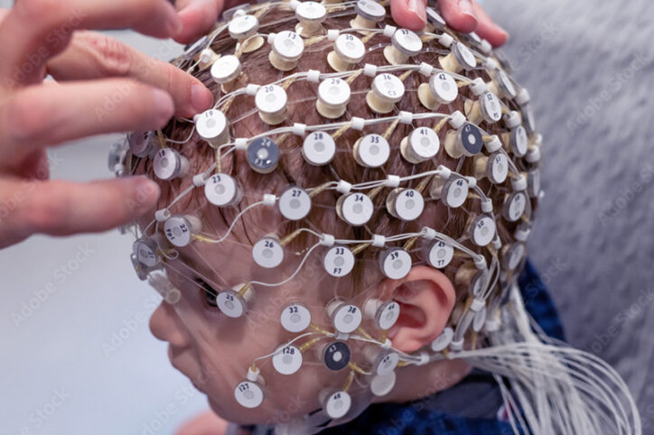 A child wearing a cap with EEG electrodes.