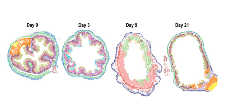 Cross sectional slices reveal changes in the intestine before, during, and after a colitis episode (days 0, 3, 9, and 21).
