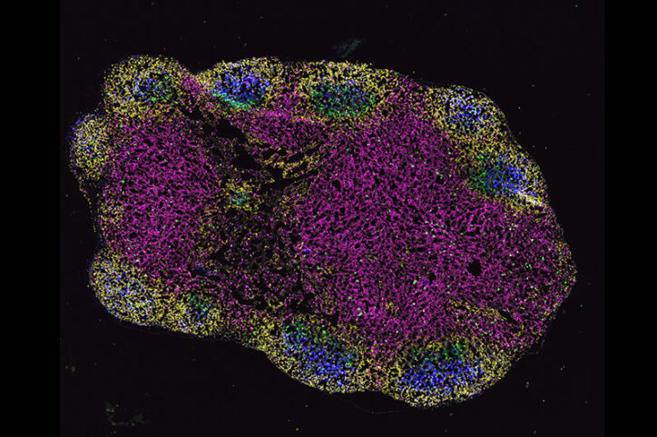 A mouse lymph node stained to show increased germinal centers and dendritic cells.