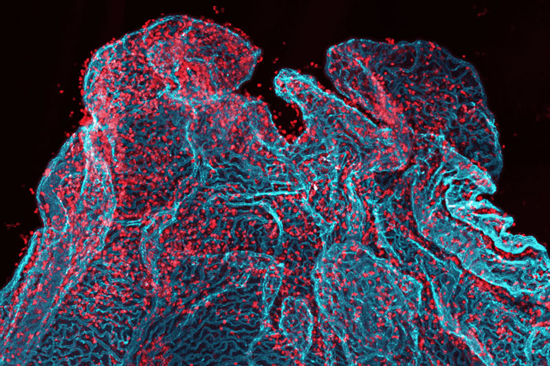 An electron microscopy image of the choroid plexus, stained to show white blood cells and blood vessels.