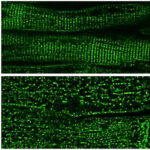 Under magnification, healthy dyads show a clear architectural alignment. During heart failure, their structure collapses.