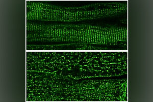 Under magnification, healthy dyads show a clear architectural alignment. During heart failure, their structure collapses.