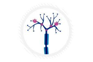 Drawing of a nerve ending with macrophages clustered at the axon tips.