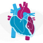 Arrows show the flow of blood on an illustration of the heart.