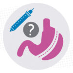 An illustration of a question mark between a medical needle and a stomach that has undergone bariatric surgery.