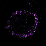 Staining reveals a ring of NPM1 around a cell.