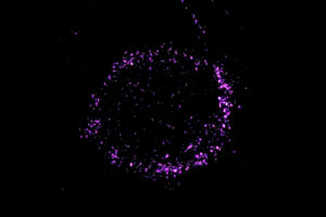 Staining reveals a ring of NPM1 around a cell.