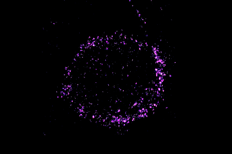 Staining reveals a ring of NPM1 around a cell.