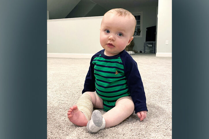 A baby sitting on a carpeted floor with a bandage wrapped around his right lower leg.