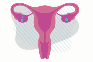 Illustration of the female reproductive system, showing the uterus, fallopian tubes, and ovaries.