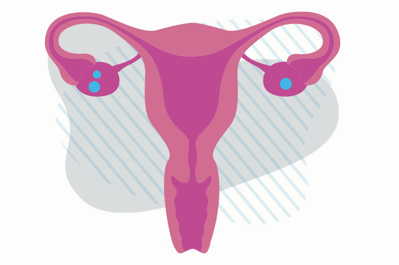 Illustration of the female reproductive system, showing the uterus, fallopian tubes, and ovaries.