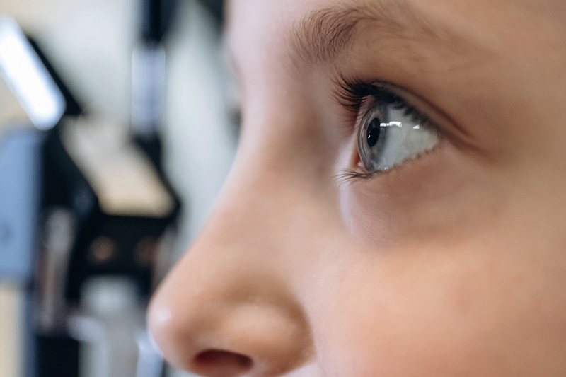 Close-up profile of a child’s face, focusing on their right eye during an eye examination.