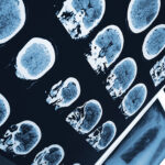 Multiple head MRI films arranged on a lighted wall.
