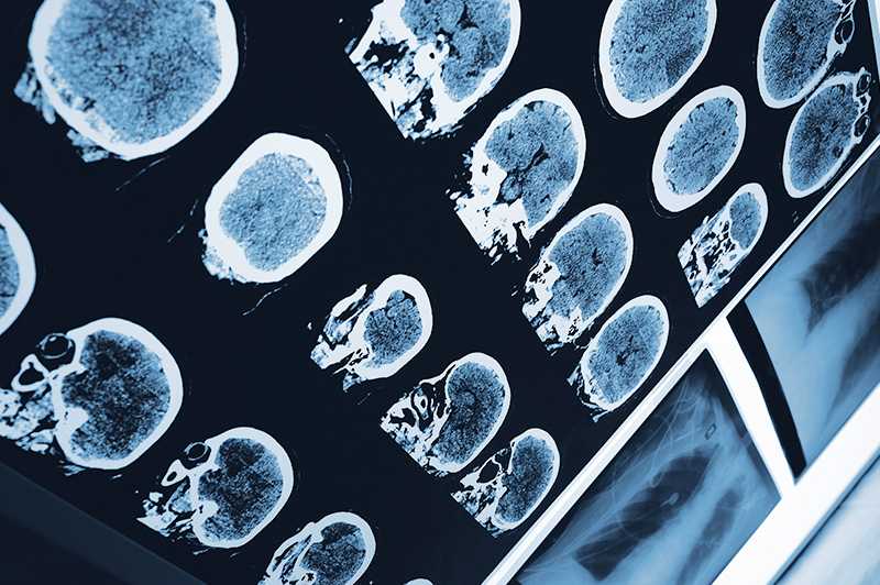 Multiple head MRI films arranged on a lighted wall.