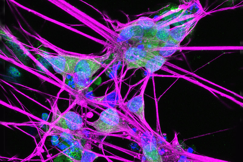 A close-up image of neurons with bright colors to highlight their structure and details.