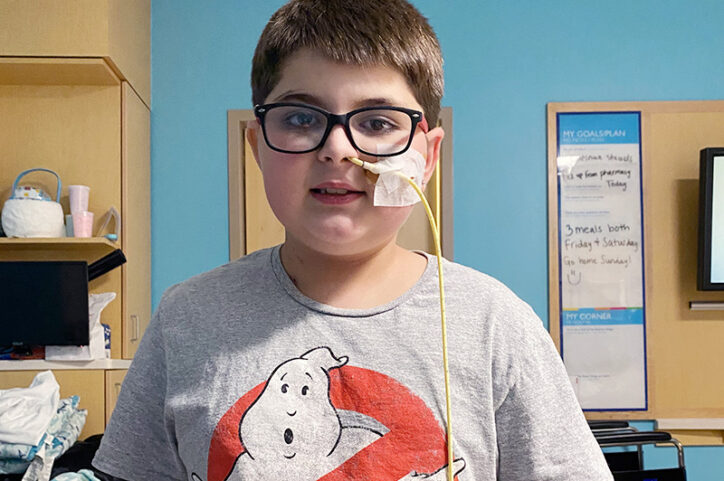 A preteen boy with a feeding tube in his nose