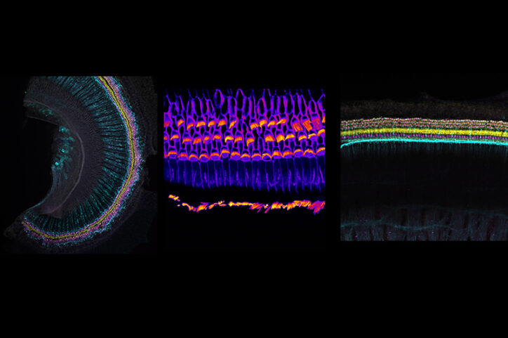 Three microscope images of cochlear tissue showing layered, repeating rows of sensory cells in cross-section and side views.
