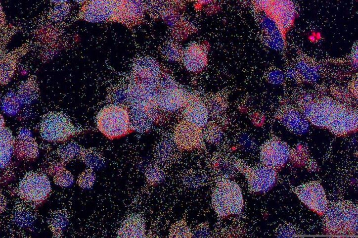 Blobs speckled tumor cells.