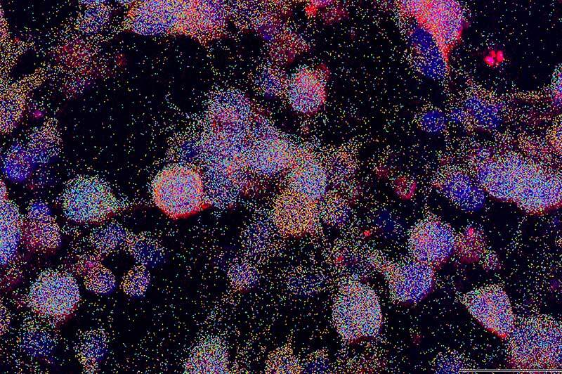 Blobs speckled tumor cells.