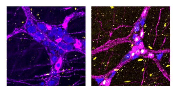 Two images side-by-side each with a branched neuron.