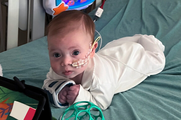 A small baby with a nasogastric (NG) tube